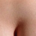 anal_400