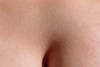 anal_400